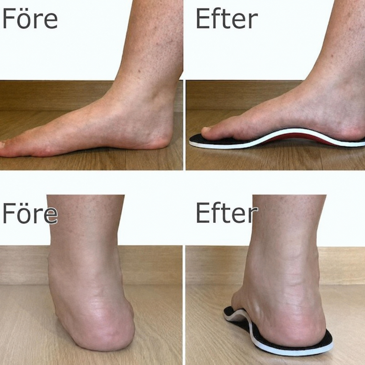 FotFokus™ – Förstärkt Fotvalvsstöd för Smärtfria Steg